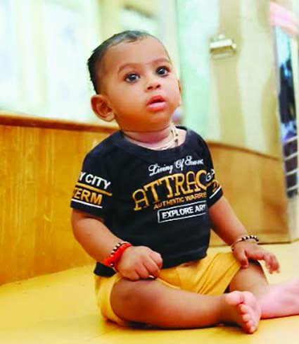 Explained what it means to fall under the SAM category of severe malnutrition