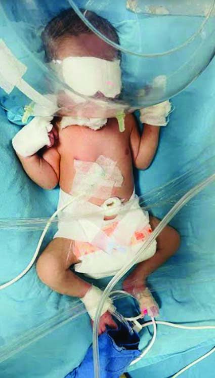 Viraj's Chief Minister's Hair Treatment Scheme